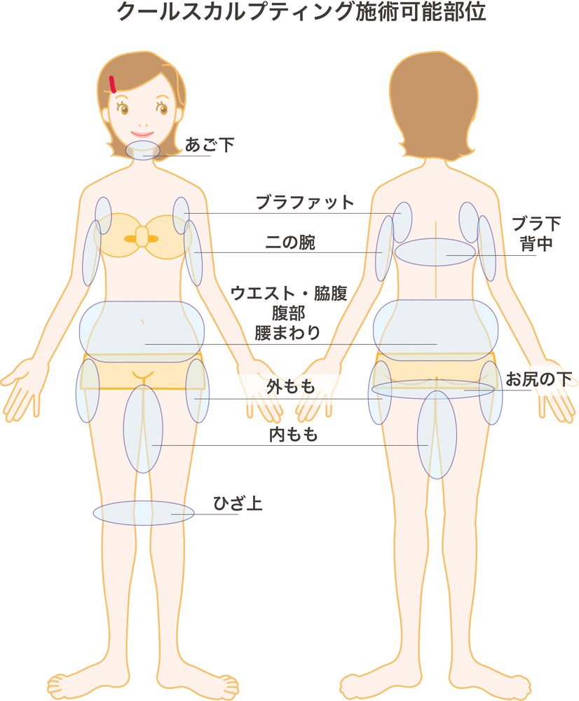 クルスカ治療部位イラスト