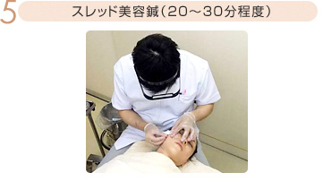 スレッド美容鍼(20〜30分程度)