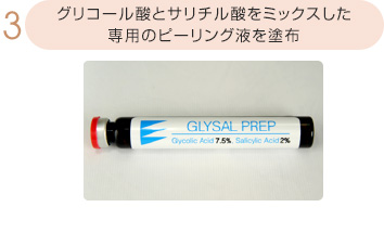 グリコール酸とサリチル酸をミックスした専用のピーリング液を塗布