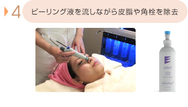 ピーリング液を流しながら皮脂や角栓を除去