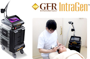 イントラジェン(GFR)