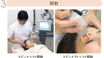 3.照射