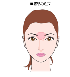 ■眉間の毛穴