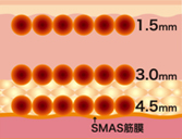 説明のイメージ