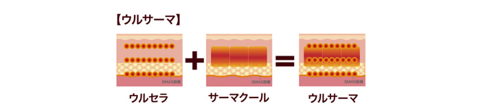 【ウルサーマ】効果イメージ