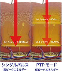 シングルパルス 高ピークエネルギー PTPモード 低ピークエネルギー